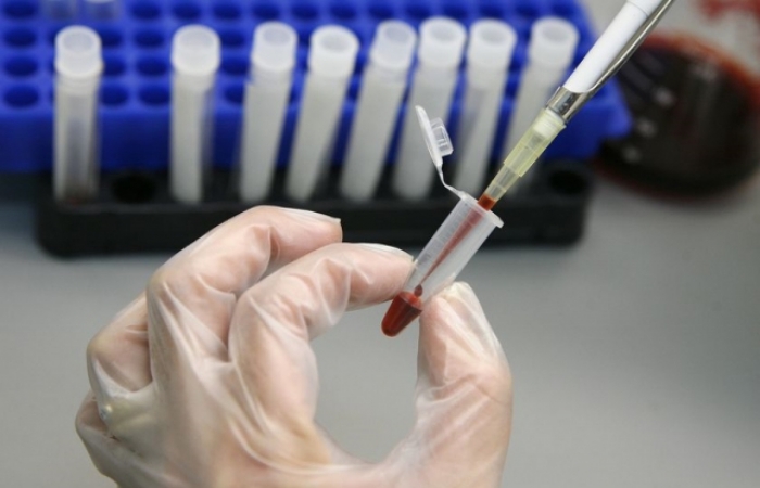 Ужгородські епідеміологи готуються до сплеску захворюваності на вірусний гепатит