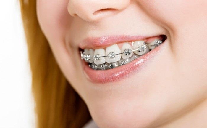 З 1 вересня студенти-стоматологи УжНУ опановуватимуть омріяний фах багатьох — ортодонтію!