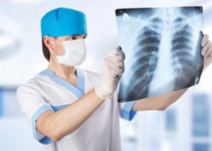 Епідемія туберкульозу: яка ситуація на Закарпатті?