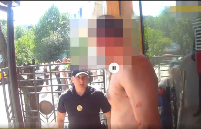 У мережі показали відео як як агресивний чоловік вдарив ужгородського патрульного по голові