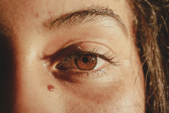 Цікаво знати: правила догляду за шкірою навколо очей