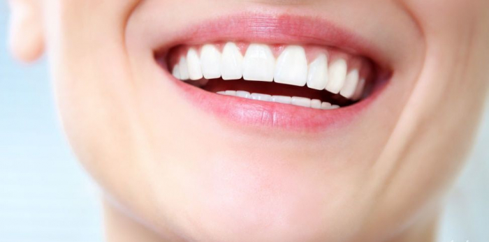 «Про жіночу красу та здоров’я»: користь і шкода від процедури відбілювання зубів 