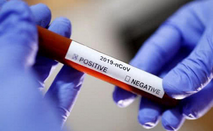 Закарпаття очікує на тест-системи для виявлення коронавірусу
