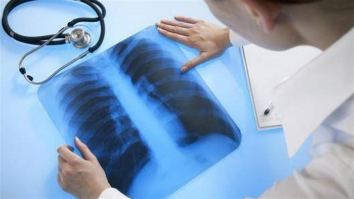 Лікарі занепокоєні: Закарпаттю загрожує епідемія туберкульозу