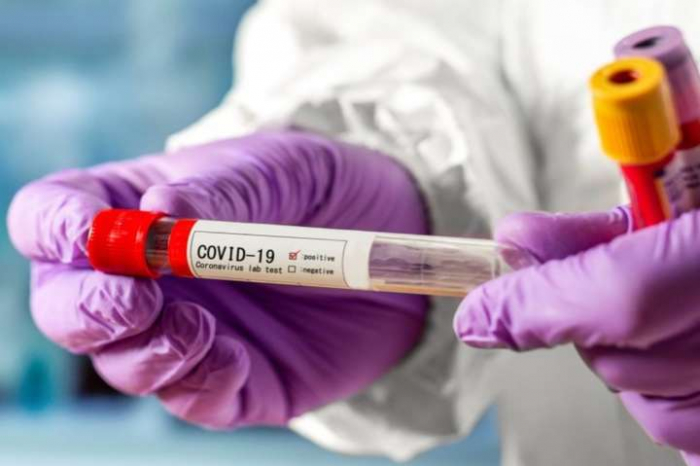 COVID-19: на Закарпатті зафіксували першу смерть від коронавірусу