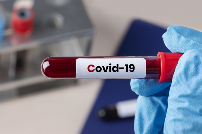 На Закарпатті за добу виявили 190 випадків COVID-19