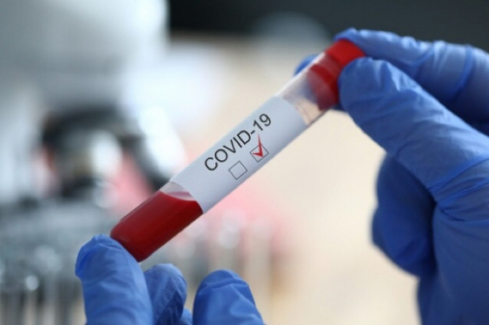 Закарпаття: 423 випадки COVID-19 за добу, померли 13 пацієнтів
