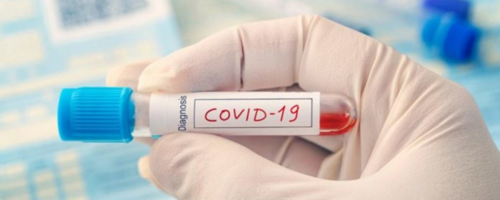  За добу на Закарпатті COVID-19 діагностували в 49 людей 
