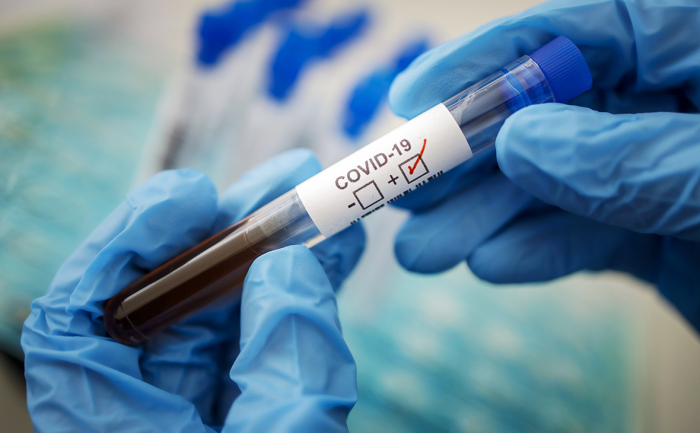 Коронавірус протягом доби на Закарпатті: 44 нові випадки