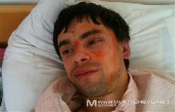 По факту побиття Віктора Щадея порушено кримінальну справу