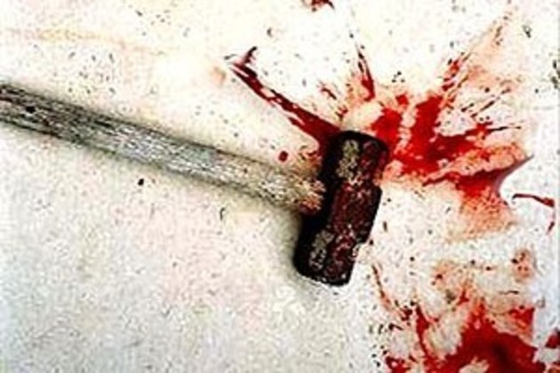 За побиття молотком та грабіж закарпатцю «світить» 15 років тюрми - прокуратура 