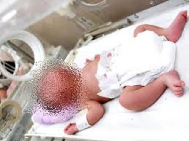 Дитину з подвійним обличчям народила закарпатська горянка