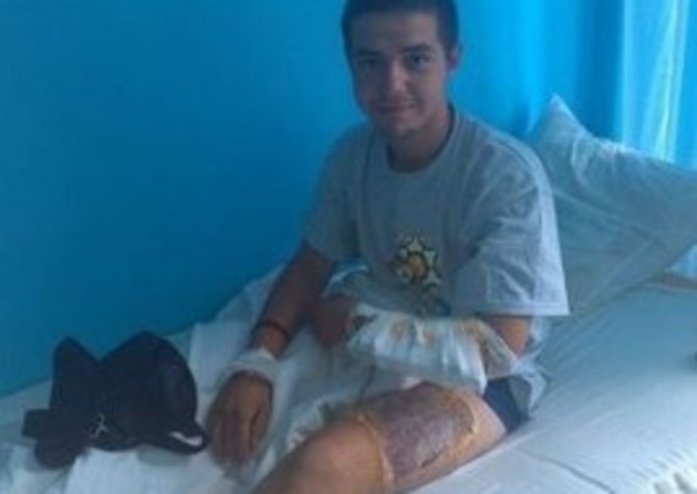 Ліками поранений під Луганськом «фосфорний» закарпатець забезпечений на тиждень