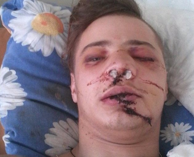 Закарпатському бійцю терміново потрібна допомога (фото)