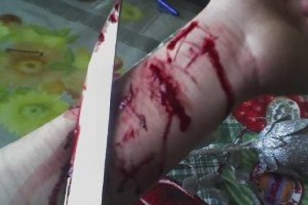 Молодий ужгородець намагався вкоротити собі віку
