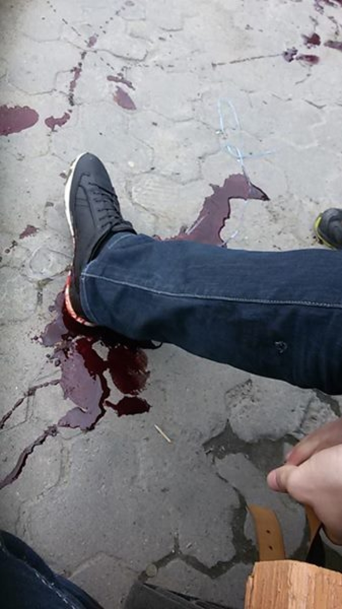 З'явилося відео з місця сьогоднішніх подій в Ужгороді