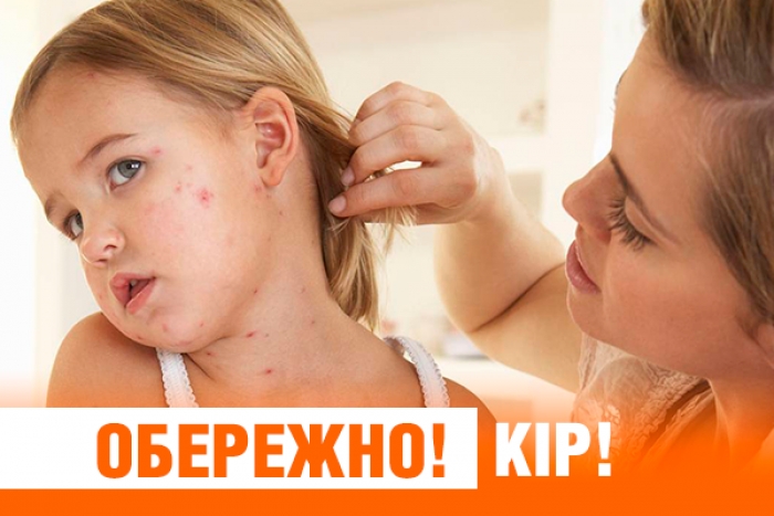Батьки і мами! Зробіть своїм дітям щеплення і захистіть їх від небезпечної хвороби!