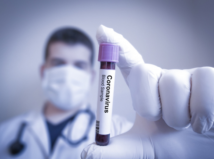 За добу в Ужгороді виявлено 44 нові випадки коронавірусної інфекції
