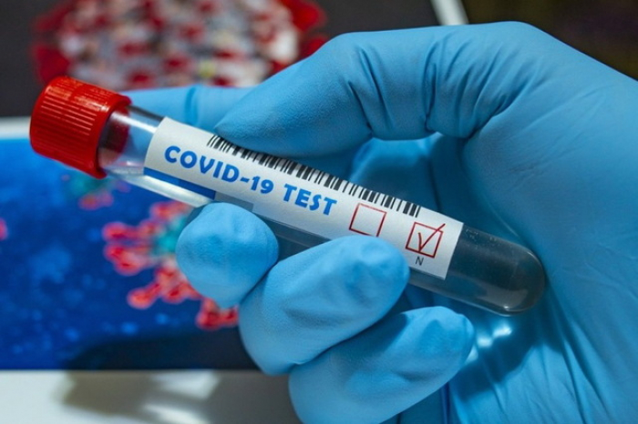 В Ужгороді за добу – 17 нових випадків коронавірусної інфекції