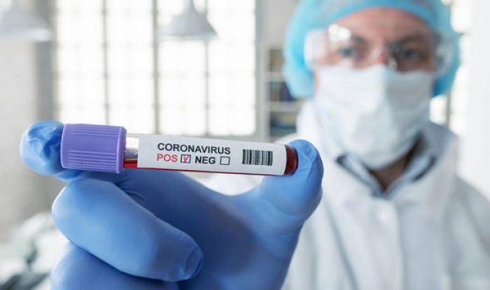 Закарпаття: за добу ще у 136 пацієнтів виявлено COVID-19