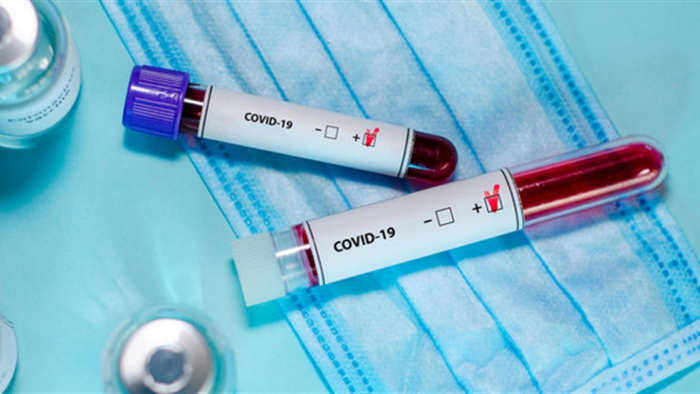 За добу в Ужгороді виявлено 33 нові випадки коронавірусної інфекції