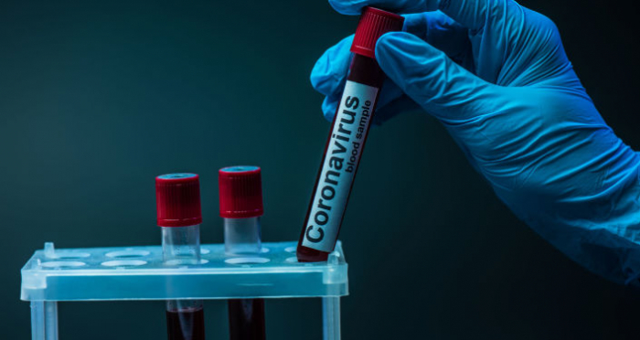 COVID-19 не покидає Закарпаття: 271 випадок за добу та п'ятеро пацієнтів померло