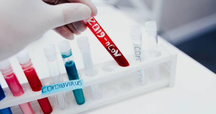 За добу в Ужгороді виявлено 28 нових випадків коронавірусу, 1 людина померла