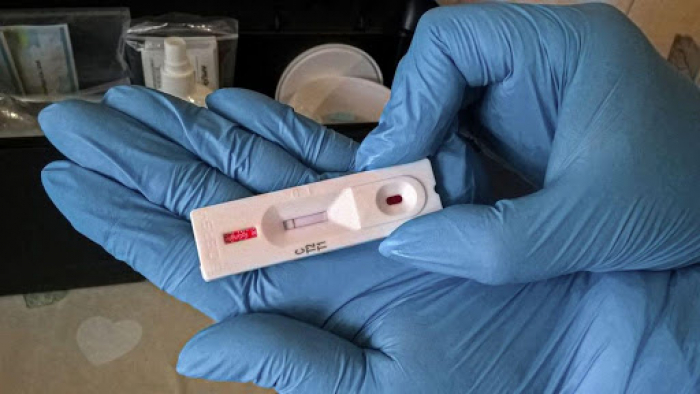 Закарпатські заробітчани здають ПЛР-тести на визначення коронавірусної інфекції