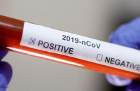 Закарпаття і COVID-19: 171 випадок за добу та двоє пацієнтів померло