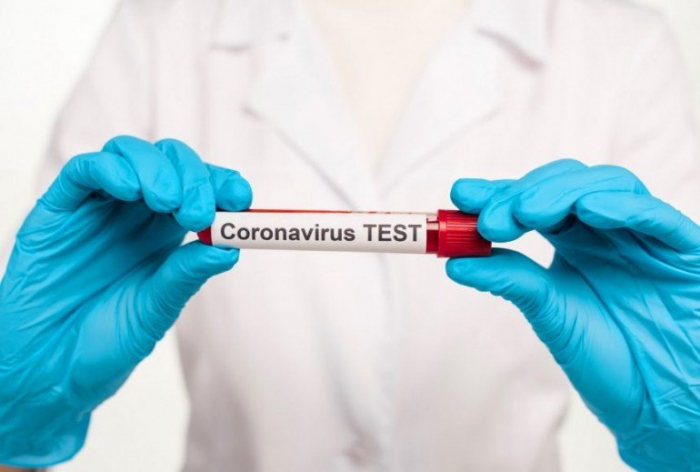 Пішло на спад: за минулу добу коронавірусну інфекцію виявили ще у 170 закарпатців