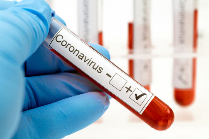 За минулу добу 128 закарпатцям підтверджено коронавірус методом ПЛР