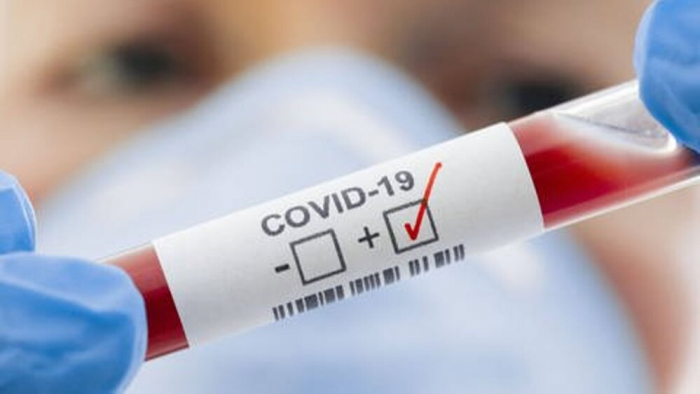 В Ужгороді за добу виявлено 64 нові випадки коронавірусної інфекції