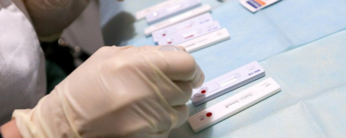 В Ужгороді охочих безкоштовно тестуватимуть на вірусні гепатити та ВІЛ
