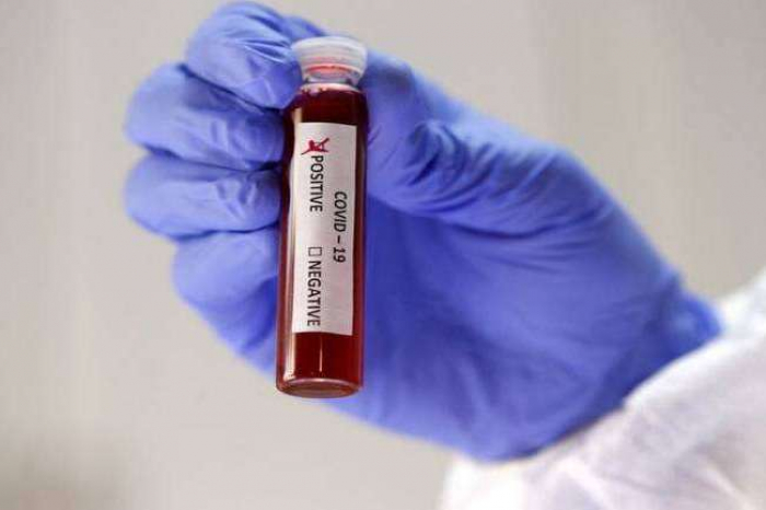 В Ужгороді за добу – 121 новий випадок коронавірусної інфекції