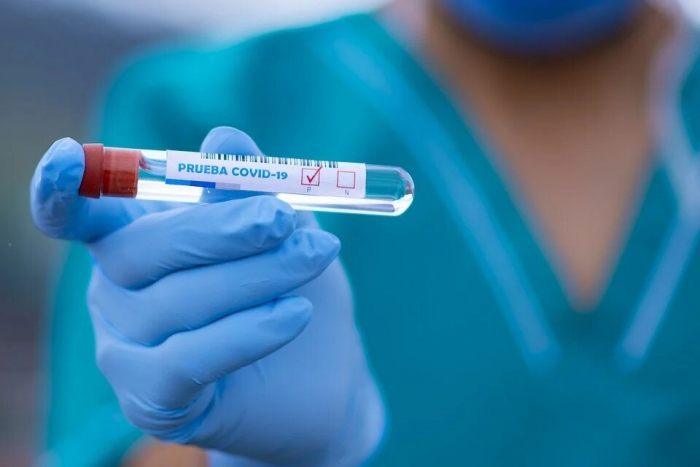 За добу в Ужгороді виявлено 101 новий випадок коронавірусної інфекції