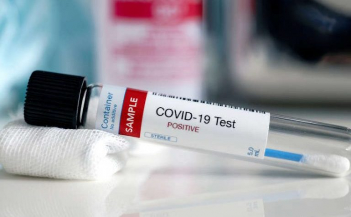 За добу в Ужгороді виявлено 77 нових випадків коронавірусної інфекції, 2 людей померло