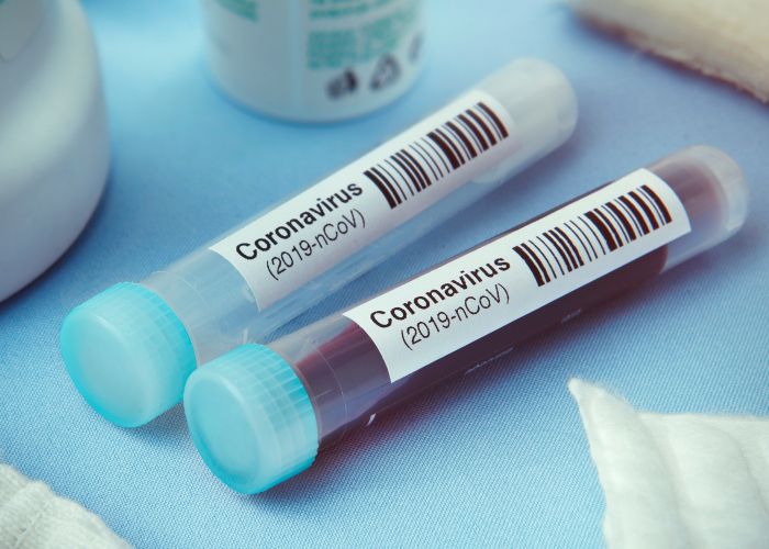 За добу в Ужгороді – 54 нові випадки коронавірусної інфекції, одна людина померла