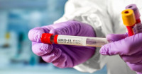 На Закарпатті медики зафіксували нові 320 випадків інфікування COVID-19 (ІНФОГРАФІКА)