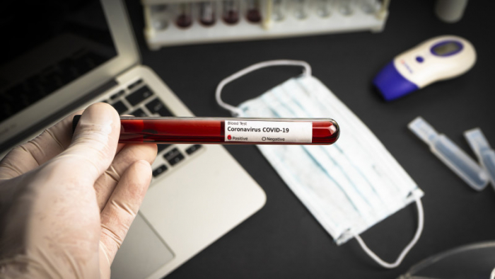 COVID-19 в Ужгороді: за добу – 31 новий випадок інфекції, 1 людина померла