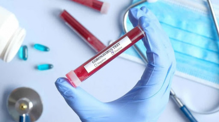 В Ужгороді виявлено 33 нові випадки коронавірусної інфекції