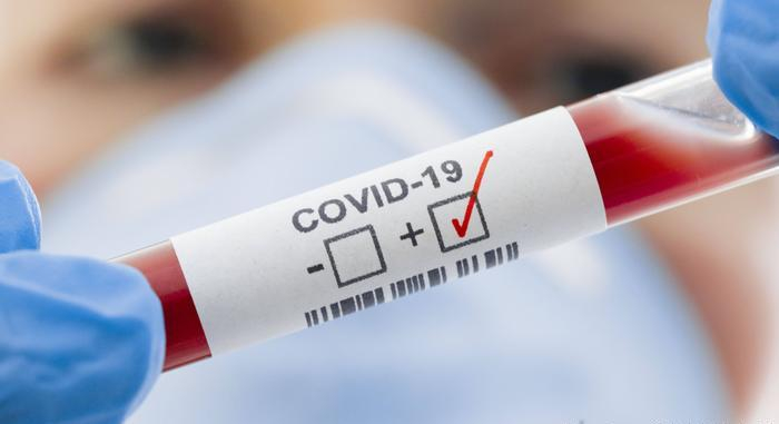 COVID-19 на Закарпатті підтвердився ще у 91 пацієнта 