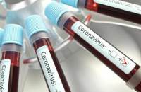 Закарпаття і COVID-19: 223 випадки за добу та 8  пацієнтів померли