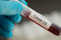 За минулу добу в Закарпатті 417 пацієнтів одужало від COVID-19 (ІНФОГРАФІКА)