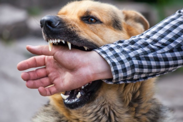 В Ужгороді щорічно з травмами від укусів собак до лікарів звертається мінімум 120 осіб