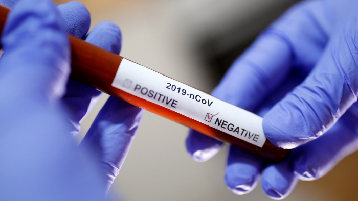 У 25-річної ужгородки, яка повернулась з Італії із симптомами коронавірусу – тест негативний! 