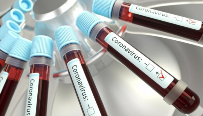 На Закарпатті ще чекають на  лабораторні аналізи по 4 особах з підозрою на коронавірус

