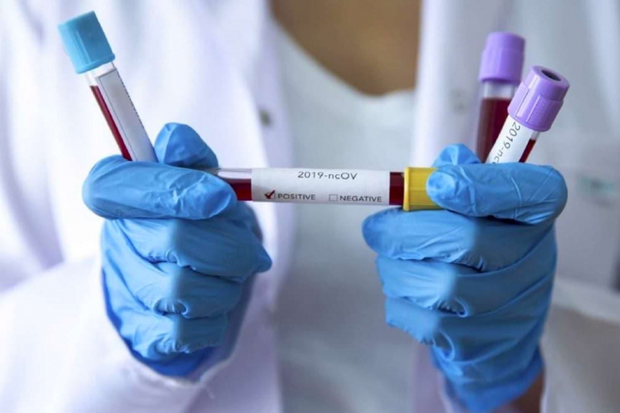 Як ужгородські приватні клініки й лабораторії тестують на коронавірус