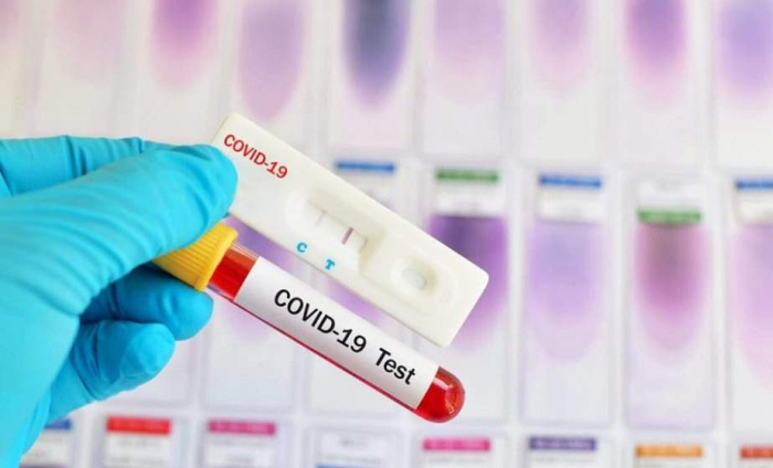 COVID-19 на Закарпатті: вже 1104 особи з коронавірусом