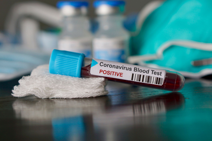 В Ужгороді – 10 нових випадків коронавірусної інфекції за минулу добу