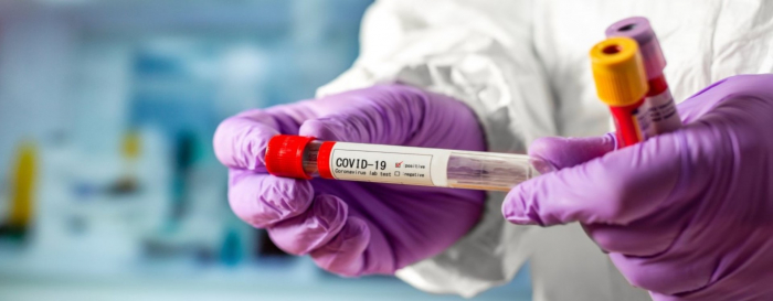 В Закарпатті 922 пацієнтам підтверджено COVID-19